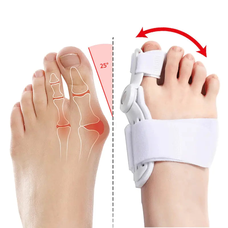 2Pcs Hallux Valgus Corrector