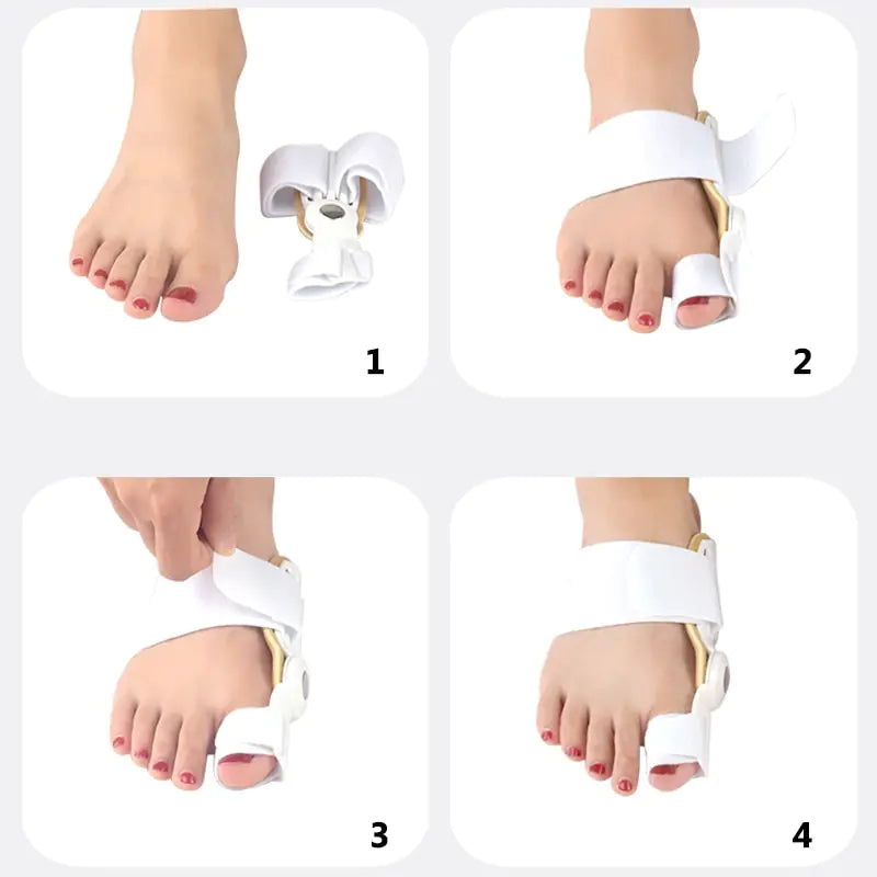 2Pcs Hallux Valgus Corrector